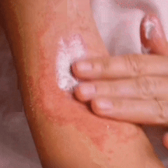 VitaDomus Cremă pentru Eczeme și Psoriazis