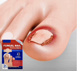 VitaDomus Plasturi antifungici pentru unghii