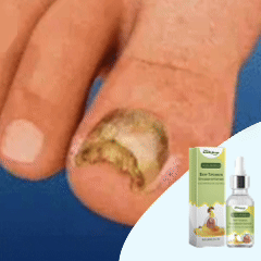 VitaDomus Ser natural cu venin de albine pentru unghii